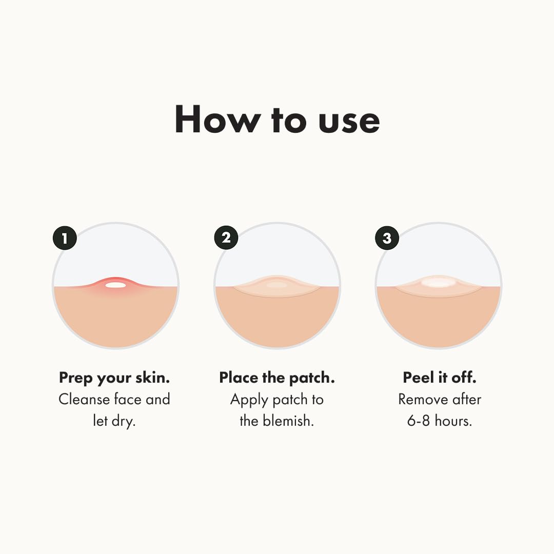 PurePatch Acne Shield