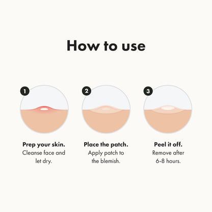 PurePatch Acne Shield