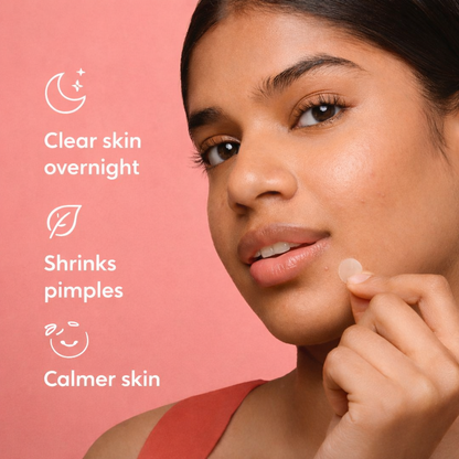 PurePatch Acne Shield